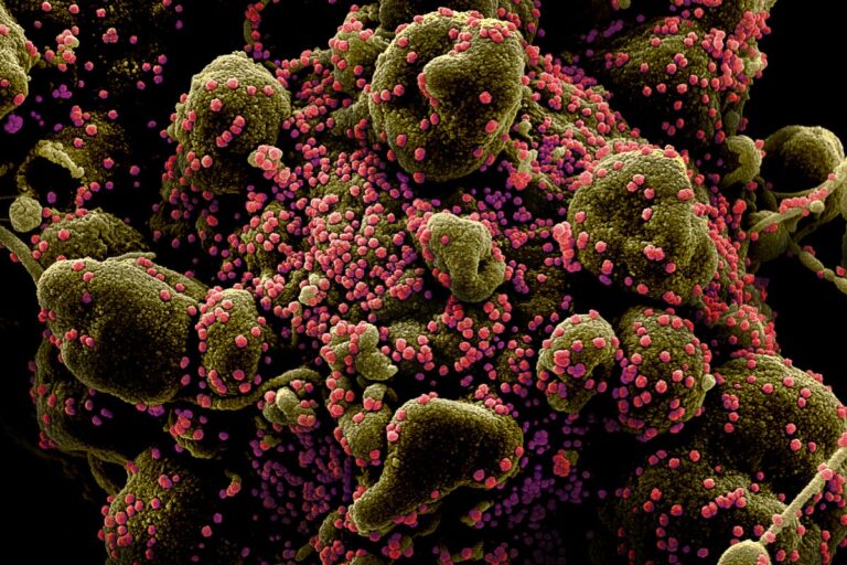 sars cov 2 infected apoptotic cell sem