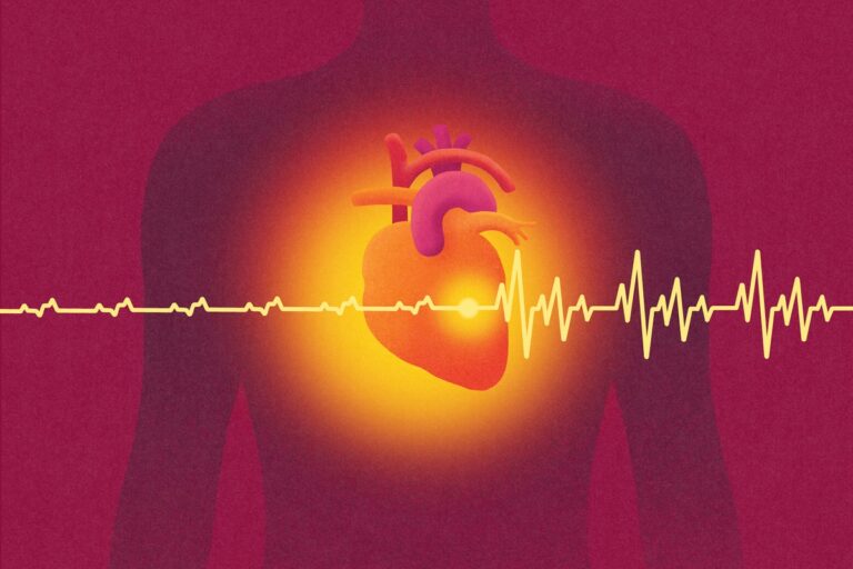 pacemaker concept illustration